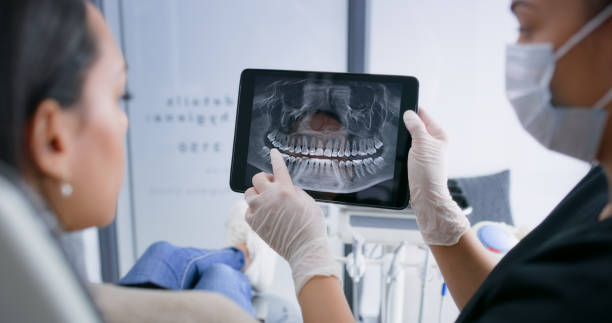 Licensed Wisdom Tooth Removal service in Holliday, TX - Smile Center Dentistry